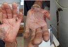 Polícia Civil cumpre mandado de prisão contra homem suspeito de tentar matar a companheira com foice em José Raydan