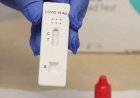 Teste positivo de Covid em farmácia registra novo pico do mês nesta segunda