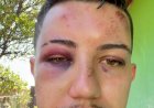Após passar mal, jovem agredido por PM é levado pela família para hospital de BH