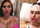 Modelo do site Onlyfans quer título de ‘maiores lábios do mundo’