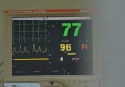 Cardiologia mundial redefine o conceito de infarto e reforça: exame de sangue alterado, sozinho, não fecha o diagnóstico