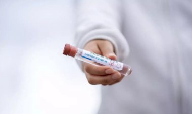 Minas registra 7.812 casos de Covid-19 em 24 horas, novo recorde