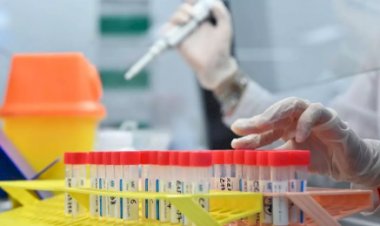 Minas investiga 55 casos suspeitos de reinfecção por Covid-19; saiba onde
