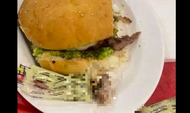Mulher encontra dedo decepado ao morder hambúrguer; restaurante admite culpa