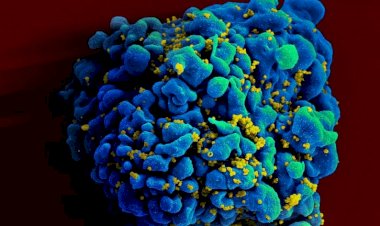 Nova cura de paciente com HIV não é aplicável em larga escala