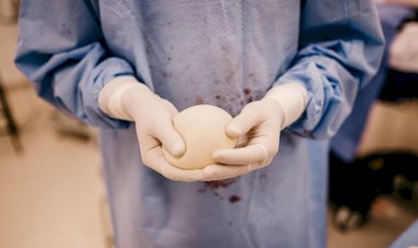 BH: Mulher que teve silicone rompido será indenizada em R$ 37 mil