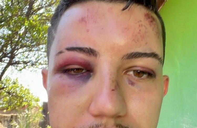 Após passar mal, jovem agredido por PM é levado pela família para hospital de BH