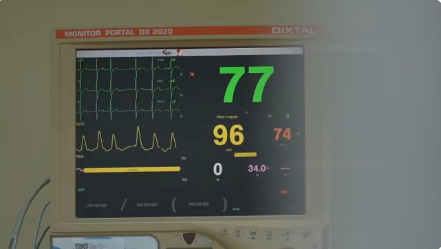 Cardiologia mundial redefine o conceito de infarto e reforça: exame de sangue alterado, sozinho, não fecha o diagnóstico